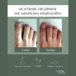 Erlebe gesunde Nägel mit dem Health Routine Nail Care Pen: 100 % Effektive Pflege bei Nagelpilzinfektion für schöne Fingernägel und Fußnägel