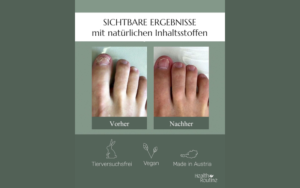 Read more about the article Erlebe gesunde Nägel mit dem Health Routine Nail Care Pen: 100 % Effektive Pflege bei Nagelpilzinfektion für schöne Fingernägel und Fußnägel